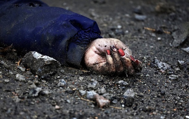 Окупанти в Гостомелі випалили на тілі дівчини свастику - Арестович